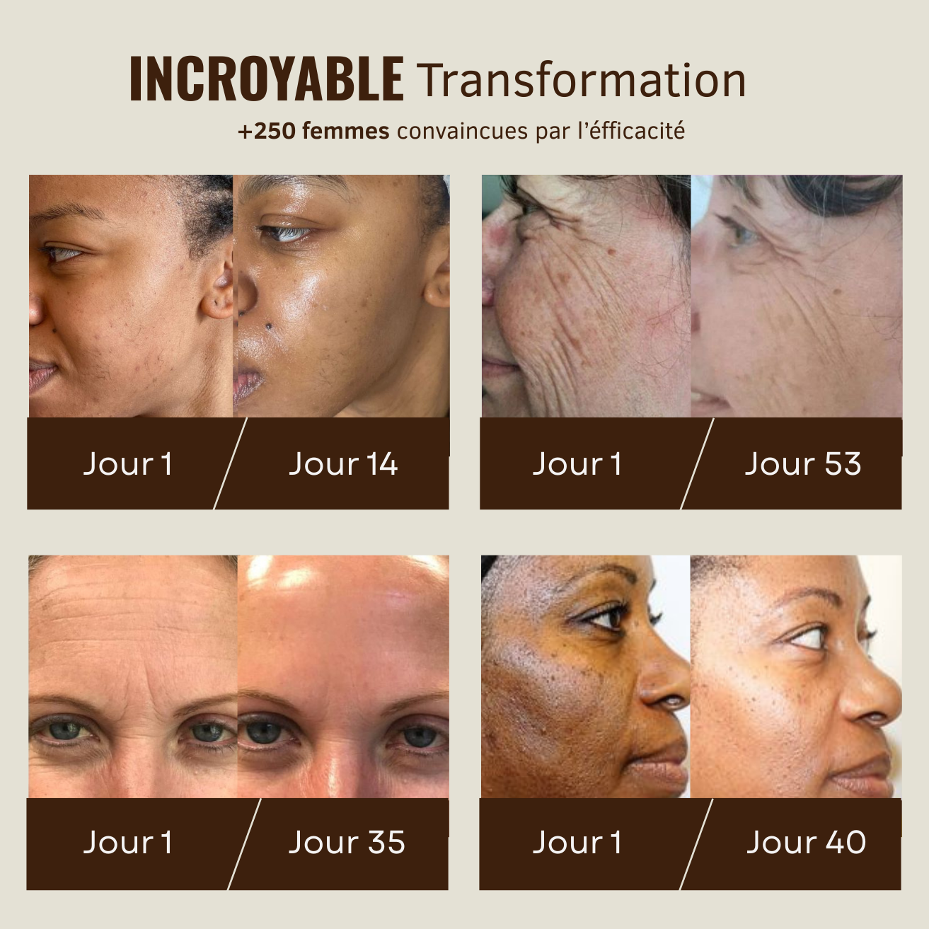 Huile de marula anti-âge